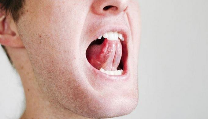 Kilka prostych ćwiczeń dla gardła i języka może złagodzić sytuację z chrapania. / Zdjęcie: i2.wp.com. 