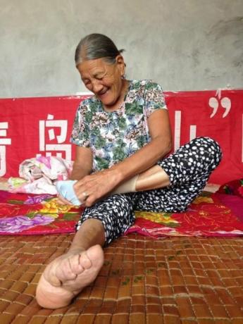 Ofiary chińskiej urody, którzy mają zaskakująco małe stopy. / Zdjęcie: interesnoznat.com. 